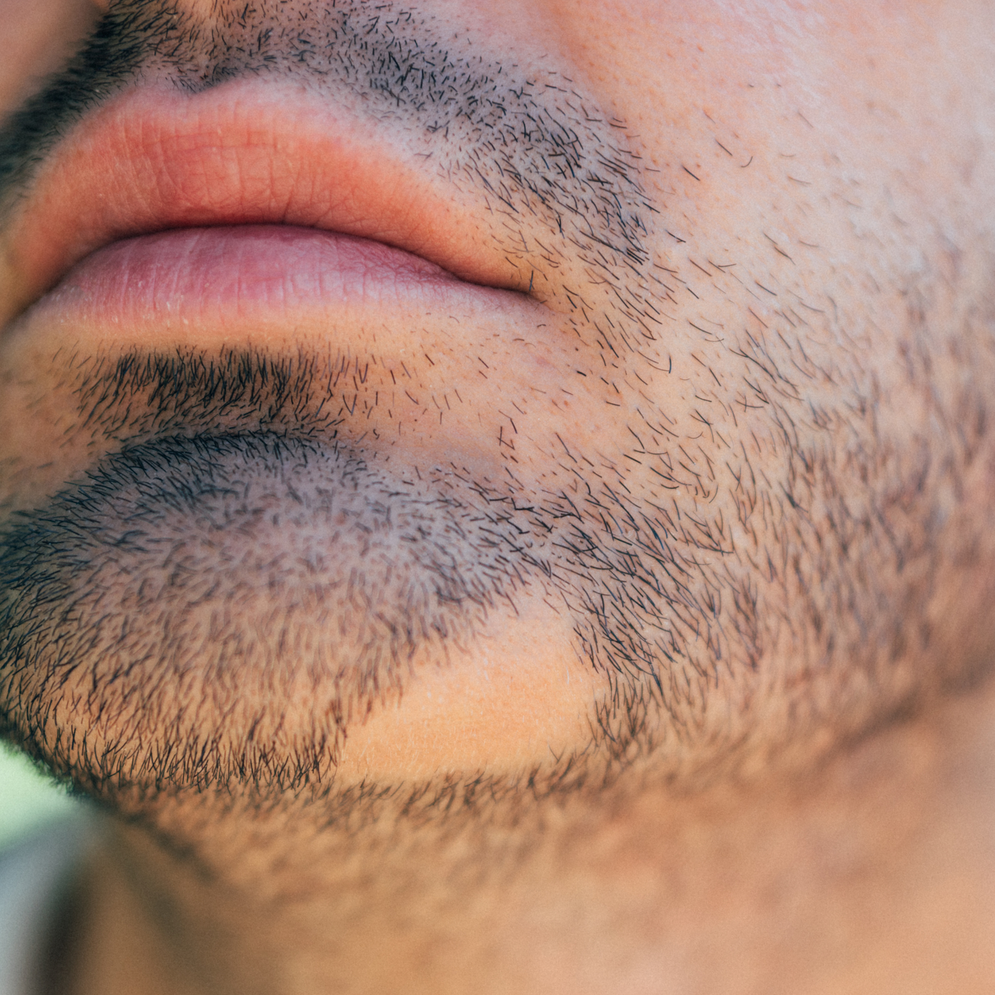 AlopeThol Homogenous Beard System | Sakal Yoğunluk ve Bölgesel Destek Protokolü